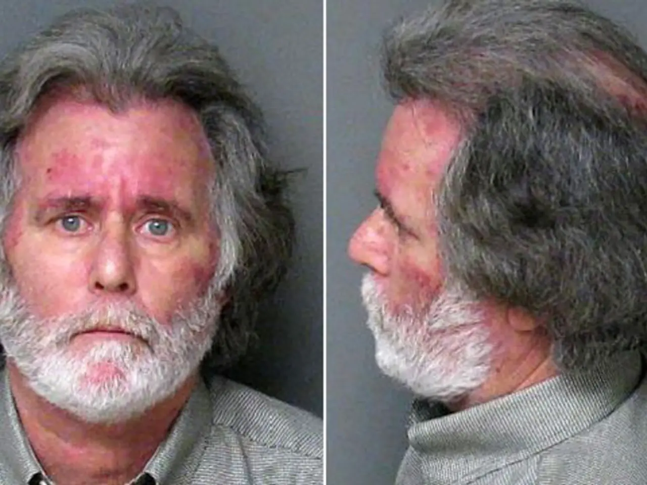 Admission of a Person Suffering from a Criminal Act