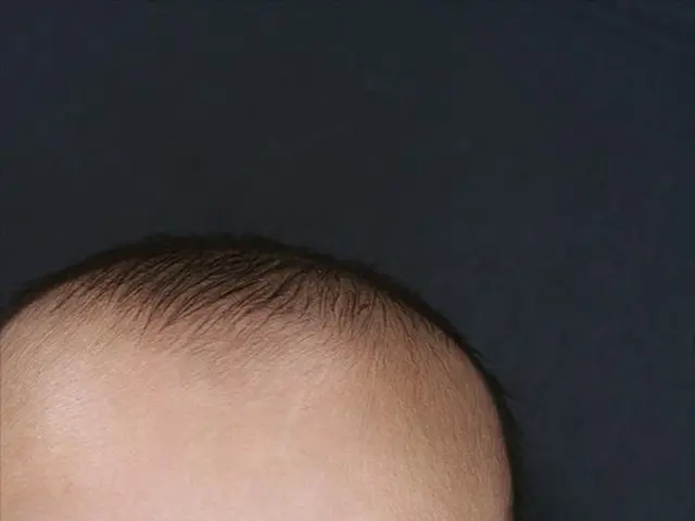 Enhanced Fetal Activities During Week 26