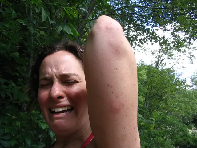 Connection Between Anxiety and Outbursts of Anger?