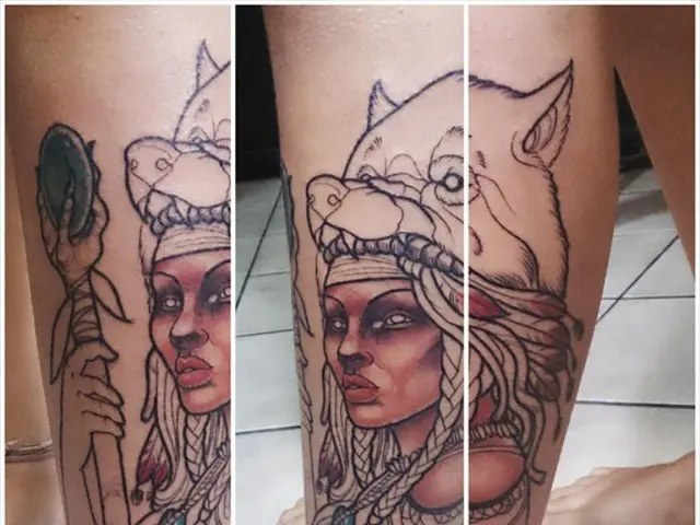 Surgeon, specializing in vascular issues, who employed dry ice to freeze his own legs, sentenced...