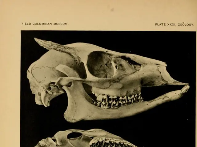 "Claiming Brain Death Is Misrepresentation: Understanding the Definitions of Death"