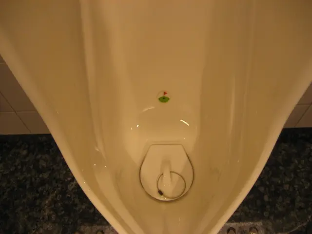 Frequent Urination Questions: "What's Causing Frequent Urination?"